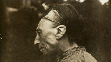 personas modifican su craneo