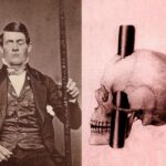 se clavo una barra en el craneo