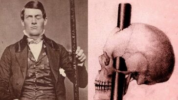 se clavo una barra en el craneo