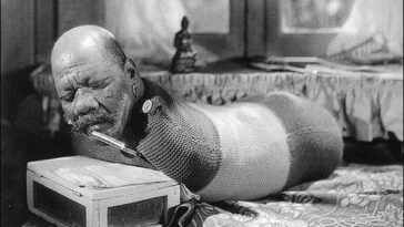 el hombre sin extremidades