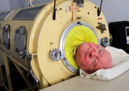 vive en un pulmon de hierro