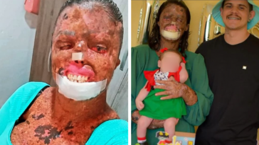 historia de amor enfermedad